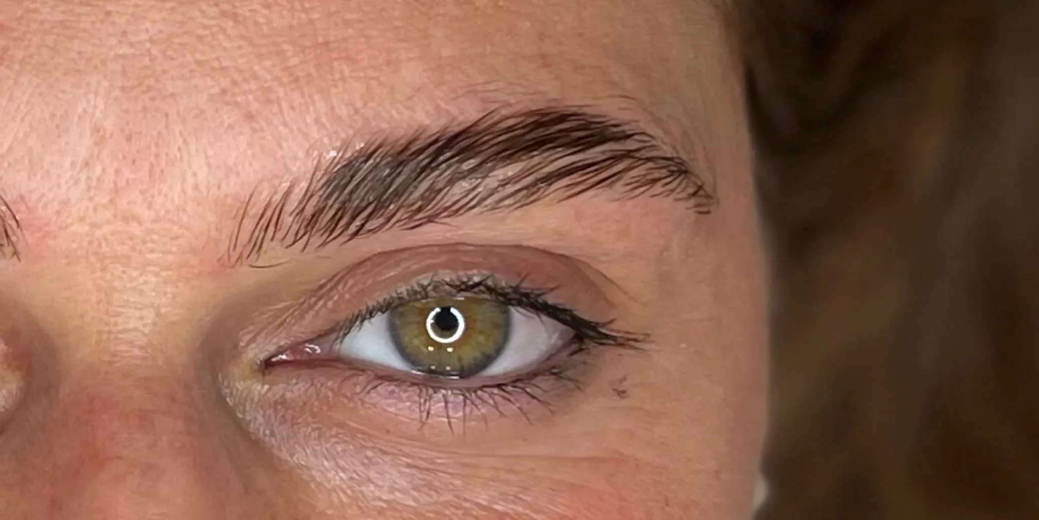 Rigenerazione Arcata Sopracciliare - Dopo